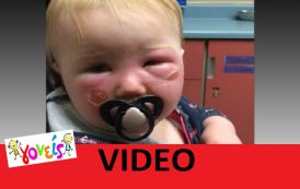 VIDEO: Αντηλιακό «για παιδιά» προκάλεσε ΑΥΤΟ σε μωρό 1 έτους